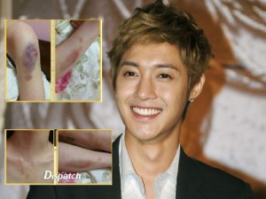 แฟนคลับ แห่ให้กำลังใจคิมฮยอนจุง สู้ข้อหาทำร้ายแฟนเก่า